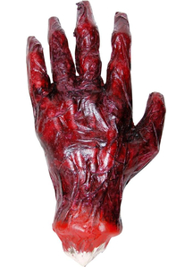 Burnt Hand
