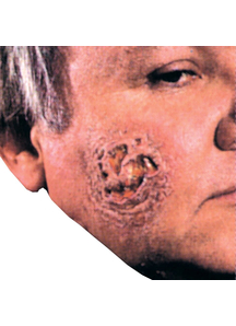 Pus