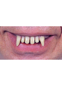Teeth Glow Ghoulio Wacky Chp