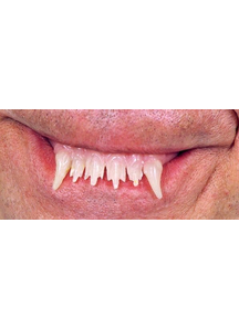 Teeth Glow Werewolf Witch
