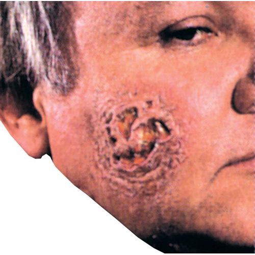 Pus