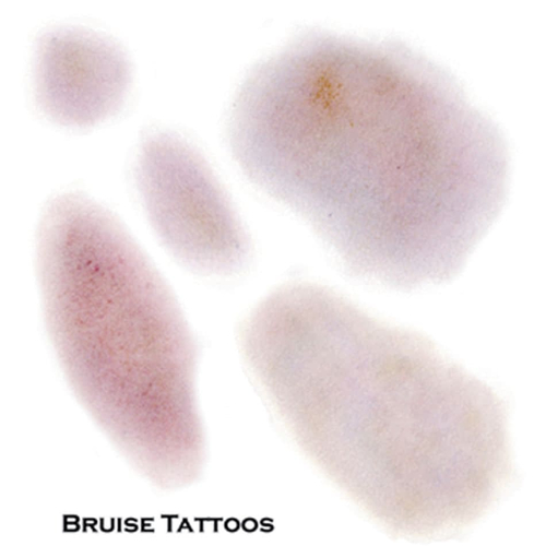 Tattoo Bruise Fx