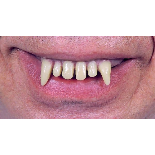 Teeth Glow Ghoulio Wacky Chp