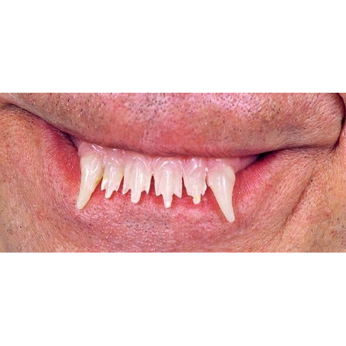 Teeth Glow Werewolf Witch